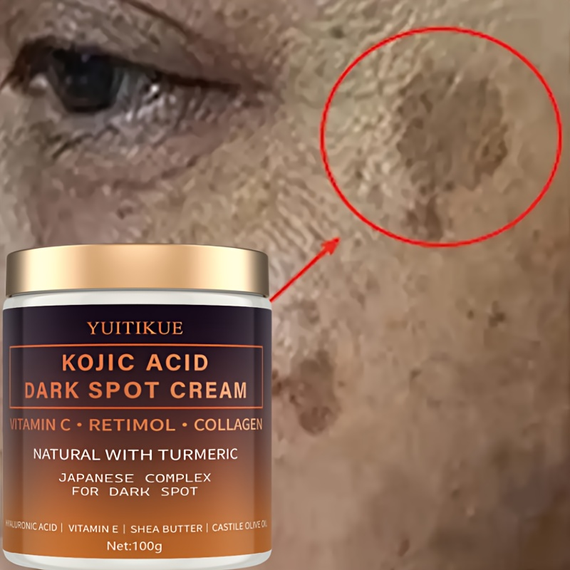 Retinol Vitamin A Cream - Crema decolorante de arbutina, vitamina C,
